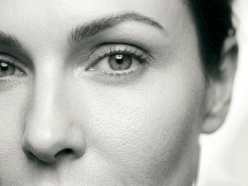 Blefaroplastia, região dos olhos