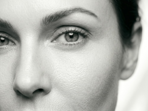 Blefaroplastia · referência de resultado