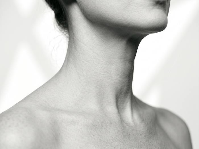 Deep Neck Lift · referência de resultado